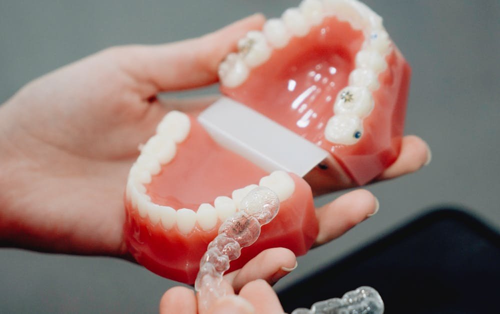 How Does Invisalign, Clear Aligners Work?