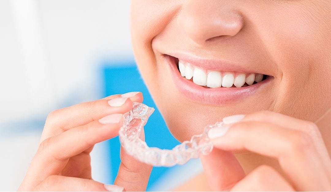 All About Invisalign Clear Aligners, Process, Cost & More